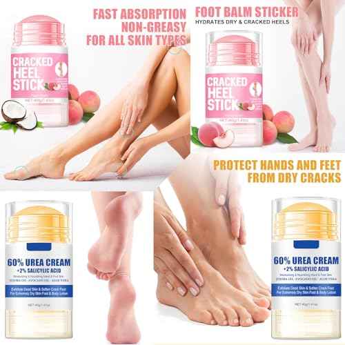 2pcs 60% Urea Hydrating and Anti-Cracking Foot Cream, 2025 Upgraded Moisturising and Relieves Cracking and Dryness Foot Cream for Dry Cracked Feet And Hands£¨aloe + peach£©