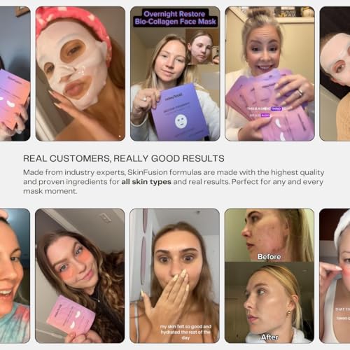 Collagen Under Eye Mask Patches (Anti-Aging + Firming 20 Pairs) with Niacinamide + Peptides - Anti-Aging, Fine Lines, Wrinkles, Dark Circles, Puffy Eyes, Under Eye Bags - Gifts - K Beauty