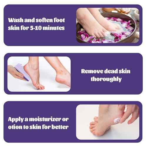 6 Pcs Foot Pumice Stone Scrubber Professional Pedicure Ped File Scrubber Exfoliating Rock Pumice Stone for Smooth Feet and Heels Callus Removal and Dead Skins