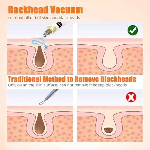 2025 Pore Vacuum, USB Rechargeable Blackhead Remover Vacuum,3 Levels Adjustable Pore Vacuum Blackhead Remover, with 5 Suction Power,6 Probes,Face Vacuum Pore Cleanser for Women & Men-Gold