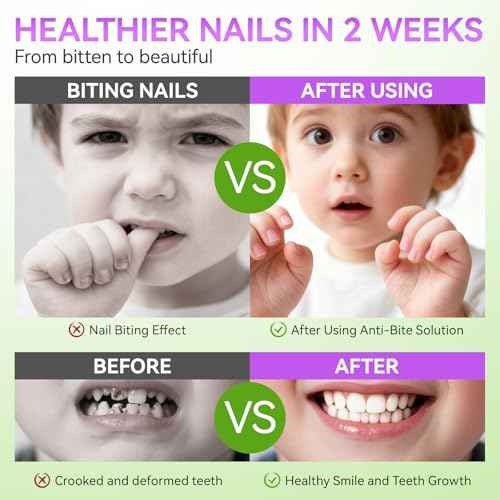 Gelike ec Nail Biting Treatment For Kids: Bitter Anti Bite Polish ? 15ml Vegan Organic Solution ? Fast Dry Long Lasting ? Stop Thumb Sucking Nail Biting ? Daily Care For Children Teens Adults