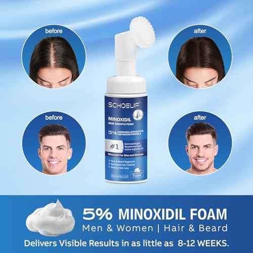5% Minoxidil Foam 1PCS, Minoxidil for Men Foam, Minoxidil for Women Hair Growth, Minoxidil Foam for Men, Minoxidil Foam for Women.