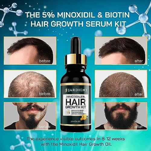 Minoxidil and Biotin Hair Growth Oil for Beards and Preventing Hair Thinning - 5% Minoxidil for Men and Women, 1 Fl Oz