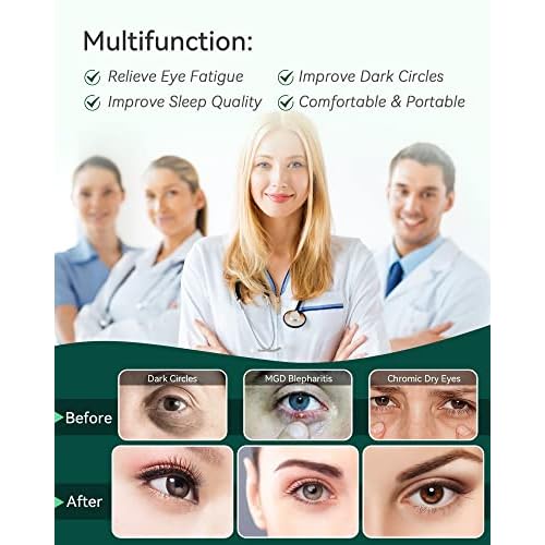 30PCS Steam Eye Masks for Dry Eyes & Fatigue Relief, Self-Heating Eye Mask for Puffiness & Dark Circles, Moist Heat Compress, Travel-Friendly, No Microwave Needed, Spa Relaxation for Women, Unscented