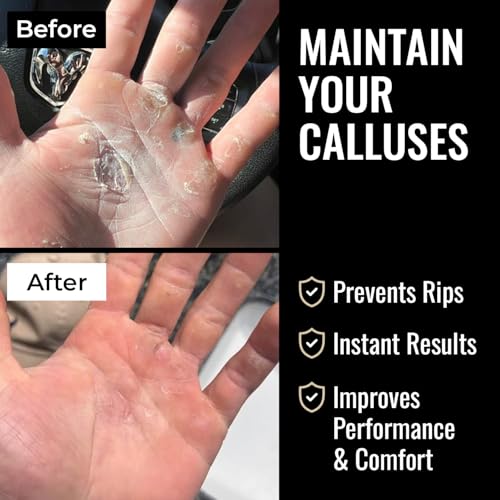 SandBar Callus Removal Deep Cleaning and Softening Set with Scraper, Hand Callus Remover Tool Salve Balm Stick for Working Hands, Dead Skin Remover Hand File 4" & 8" - Gold