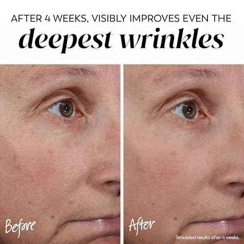 Olay Face Moisturizer, Regenerist Micro-Sculpting Cream for Women, Fragrance-Free - Hydrating, Anti-Aging, Anti-Wrinkle, Firming Skin Care - Hyaluronic Acid, Niacinamide, Amino Peptides, 1.7 Oz