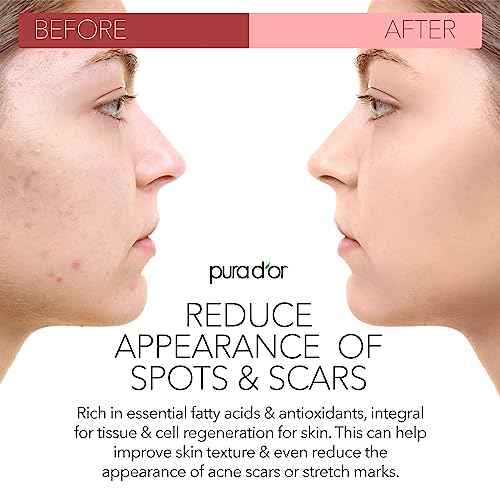 PURA D'OR 4 Oz ORGANIC Rosehip Seed Oil - 100% Pure Cold Pressed USDA Certified Anti-Aging Treatment - Vitamin A & C Rich - Helps Fade Appearance of Scars & Stretch Marks - For Face, Hair & Body