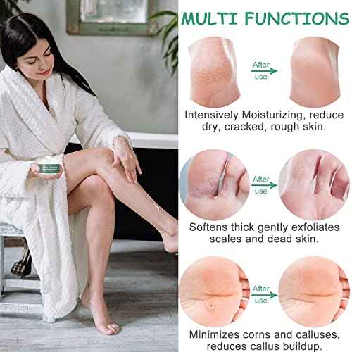 Urea Cream 40 Percent For Feet, Foot Cream, 40% Urea Lotion For Dry Skin/Cracked Heels/Ultra Calloused Feet, Softening Rough Skin On Feet, Skin Care with Glycerin, Jojoba for Men/Women, 4.3 oz
