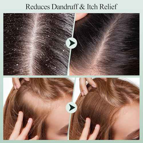 Scalp Scrub, Rosemary Scalp Exfoliator Scrub Shampoo, 2-in-1 Scalp Treatment with Mint Oil, Hair Treatment to Clarify and Remove Build Up with Silicone Scalp Massager, 10.6oz/300g