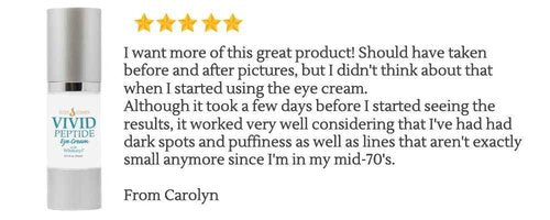 VIVID Peptide Eye Cream with Whitonyl for Dark Circles, Puffiness and Fine Lines - Brightens and Boosts Collagen for Firmness and Hydration