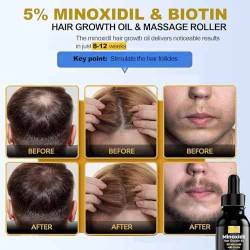 5% Minoxidil for Men Hair, Minoxidil Hair Growth Serum for Women Hair Growth, Men Beard Growth, Hair Loss Treatment with Dropper Applicator & Massage Tool
