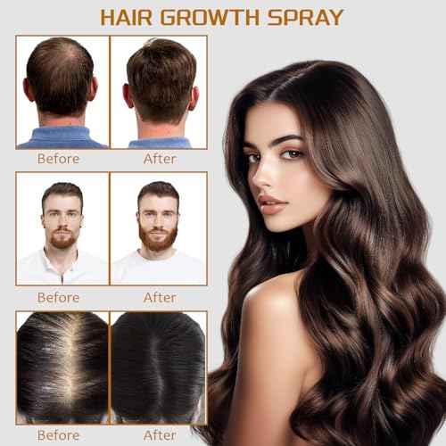 100ml 5% Minoxidil Spray with Biotin - Regrowth Treatment for Men & Women, Promotes Thicker, Stronger, Fuller Hair, Prevents Hair Loss, Minoxidil for Men Hair & Beard, Minoxidil for Women Hair Growth