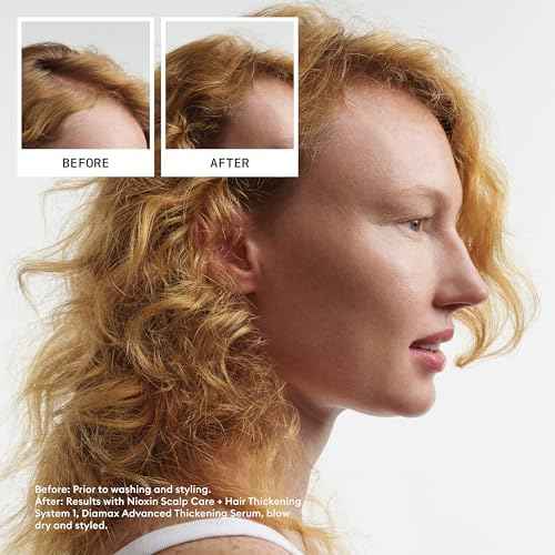 Nioxin System 1 Scalp + Hair Thickening Shampoo | For Natural Hair with Light Thinning | Strengthen Against Breakage with Niacinamide & Biotin