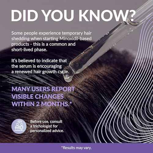 Minoxidil for Women 2% - Hair Growth Serum Women + Vitamin E, Ginseng, Ginger Extract, Biotin Hair Growth Serum - Hair Loss Regrowth & Thickening Treatment Helper