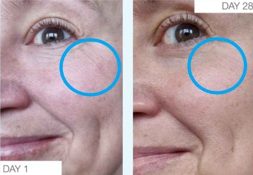 The Organic Pharmacy Niacinamide Ultra 5 Serum - Vitamin B3 Powerhouse with 5% Niacinamide, Vitamin C, Hyaluronic Acid, Bakuchiol, 1 Fl Oz