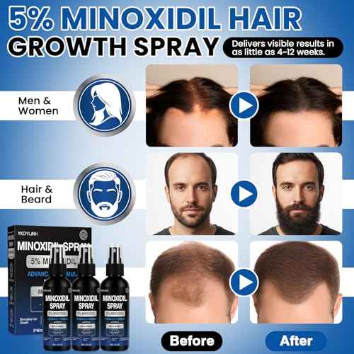 5% Minoxidil Spray,3 pack? High-Efficiency Hair Loss Product to Prevent Thinning, and Hair Regrowth Treatment for Stronger, Fuller Hair