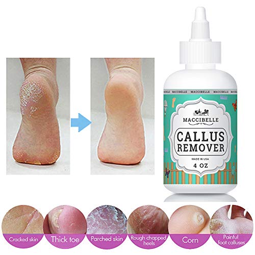 Maccibelle Callus Remover EXTRA STRENGTH For Feet, Professional Callus and Corn Eliminator Liquid Gel 4 oz (1 Bottle)