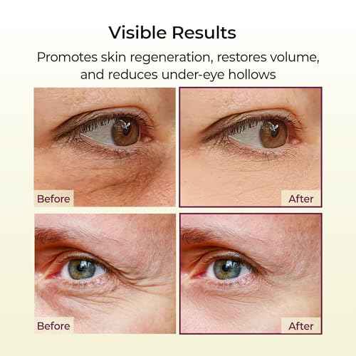 Dr.Melaxin Cemenrete Calcium Multi Balm 9g Korean Skin Care All In One Stick Collagen Face Eye treatment Balm