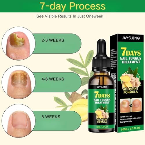 Ginger Nail Treatment Serum - Moisturize the Cuticle & Strengthen Nails and Helps Nails Healthy Grow, 1 fl.oz (Pack of 2)