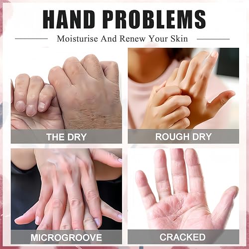 Roses & Milk Hand Repair Gloves, 5 Pairs Hydrating Hand Masks for Dry Cracked Hands, Moisturizing & Softening Gloves for Women & Men, Nourishing Hand Spa Treatment