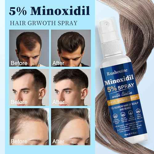 5% Minoxidil Hair Growth Spray with Brush for Women & Men, Minoxidil Biotin for Men Beard, 60ml / 2.11 fl.oz