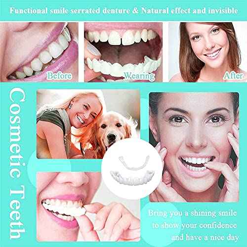 1Set Dentures Veneers Tooth,Dental Care Kits for Anti Molar Orthodontic Cosmetic Teeth,Smile Snap Tooth.(White,1Top+ 1Bottom+2Adhesives+1Tweezers+1Heart-Shaped Storage Box£©