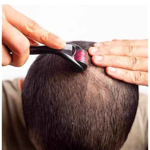 RadBizz Derma Roller and Storage Case - 0.25mm