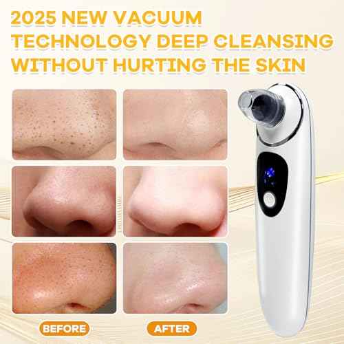 2025 Pore Vacuum with Camerafor, USB Rechargeable Blackhead Remover Vacuum,3 Levels Adjustable Pore Vacuum Blackhead Remover, 6 Suction Heads,Face Vacuum Pore Cleanser for Women & Men