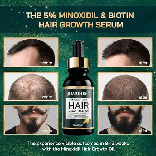 Minoxidil 5% Serum for Men and Women: Hair Growth Oil with Monoxide, Biotin, Beard Growth Kit - Minoxidil Serum - 1 Fl Oz - Prevent Hair Loss, Regrowth Treatment