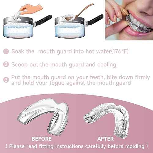 4 Pack Pink Kids Mouth Guard for Teeth Grinding,Comfortable Night Guard,Moldable Child Bite Guard for Clenching Teeth, Mouthguard for Kids