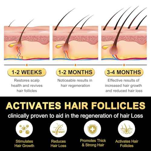 5% Minoxidil for Men and Women Hair Growth Serum, Biotin Hair Growth, Hair Regrowth Treatment for Scalp Hair Loss Hair Thinning for Thicker Longer Fuller Healthier Hair (Pack of 1)