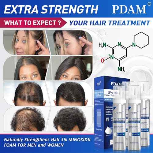 Minoxidil for Men and Women Foam Hair Growth - 5% Minoxidil Foam Hair Regrowth Treatment for Men, Topical Hair Loss Treatments, Extra Strength Thicker & Fuller Hair, 4 x 2.11 oz for 4 Months