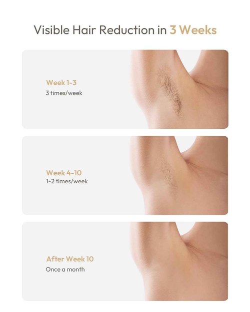 Nevvue Painless IPL Hair Removal Device, Gifts for Women, More Women Use for Facial Hair Removal, Suitable for Face Bikini Line Legs Arms Armpits