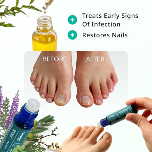 Swissklip Medi-Care Toenail Stick I KlearNail Treatment | Natural Solution for Healthy Nails I Suitable For Foot, Toe, and Fingernail I For Brittle Toenails ? 10ml / 0.3 Fl. Oz. Pack 2 - Made in USA