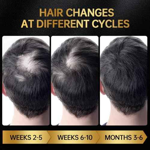 Minoxidil for Men & Women, With Biotin, Batana Oil, Rosemary Essential Oil, Effective Hair Loss Solution, Hair Loss Treatment for Hair Regrowth, Non-Greasy 5% Minoxidil - 60ml