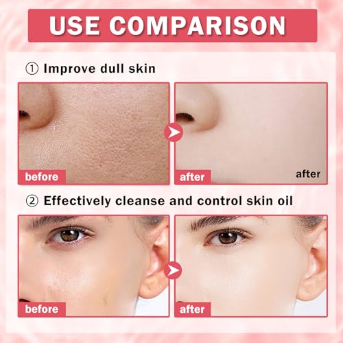 Facial Masks for Women Skin Care,10 Pack Kids Face Masks Spa,Hydraiting Hyaluronic Acid Face Mask Set for Girls,Natural Ingredients Mascarillas Faciales Para Ni?as