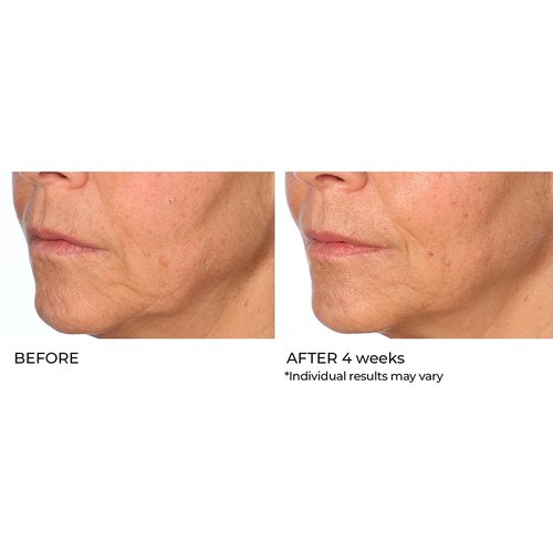 NassifMD Radiance Booster Vitamins C for Face, Brightening serum Dark Spot Remover, Vitamin C with Omega-3 and Squalene Oil