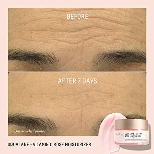 BIOSSANCE Squalane + Vitamin C Rose Face Moisturizer ? Antioxidant-Rich Day/Night Face Lotion ? Hydrates and Smooths Fine Lines ? Even Skin Tone & Reduce Discoloration ? For Radiant Skin, 1.69 Fl Oz