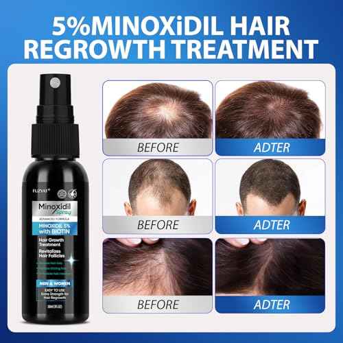 5% Minoxidil Hair Growth Spray Kit, Minoxidil for Women Hair Growth, Minoxidil for Men Hair Kit.