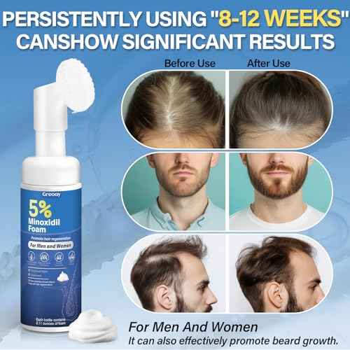 5% Minoxidil Hair Growth Foam Men and Women Suitable for Hair Thinning Receding Hairline and Hair Loss to Hair Regrowth Get Thicker Fuller Hair for Women and Men 3 Bottles 2.11 Ounces Each