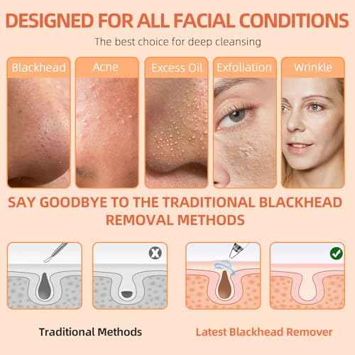2025 Pore Vacuum Kit, USB Rechargeable Blackhead Remover Vacuum Kit,3 Levels Adjustable Pore Vacuum Blackhead Remover, with 6 Suction Power Probe,4 Golden Needle face Vacuum Pore Cleanser Kit-White