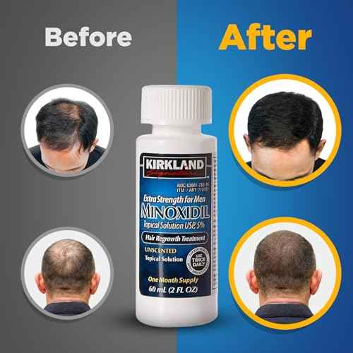 Minoxidil Liquid Extra Strength Hair Regrowth Treatment for Men, 5% Topical Solution, 6 Months Supply - Dropper Applicator and Bonus Free Instructional Guide Included