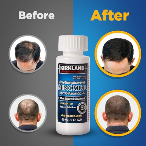 Minoxidil-5% Extra Strength Hair Regrowth for Men, 6 Month Supply
