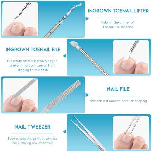 Ingrown Toenail Removal Kit, Professional Ingrown Toenail Tool Kit Includes Ingrown Toenail Corrector Drops, Corrector Patch, Toenail Clipper, Nail File Lifter Pedicure Tools
