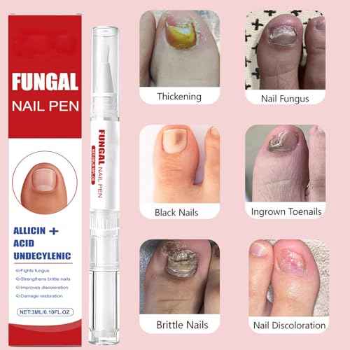 Fungal Nail Pen with Allicin & Undecylenic Acid, Extra Strength Nail Repair for Yellow, Discolored, Thick or Damaged Nails, Toenail & Fingernail Care (2PCS)