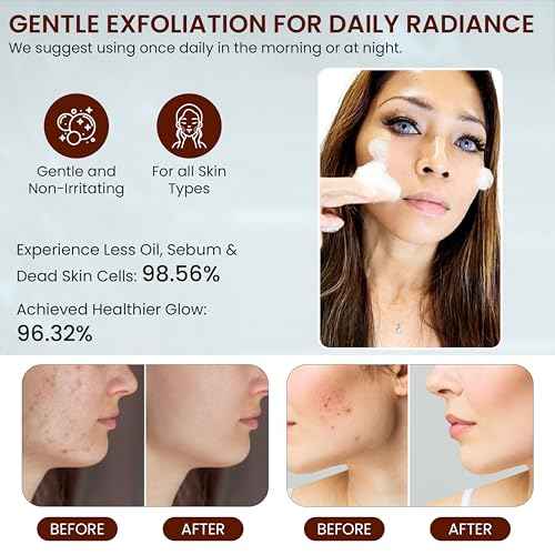 Live Healthy Turmeric Foaming Face Wash - Turmeric Face Wash with Brush, Deep Cleansing, Gentle, Facial Cleanser, Makeup Remover, Natural Formula for Acne, Blackhead & Oil Control, Hydrating -150ml