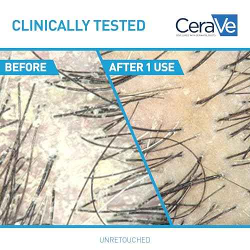 CeraVe Hydrating Anti Dandruff Shampoo, 1% Pyrithione Zinc Dandruff Treatment With Ceramides, Niacinamide & Hyaluronic Acid, Helps Eliminate Flakes & Provides Itchy Scalp Relief, Sulfate Free, 12 Oz