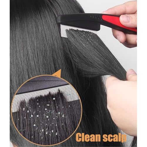 Dandruff Comb Fine Tooth Scalp Detox Comb Lice for Women, Men & Kids Stainless Steel Scalp Detoxing, Sweep & Massage Hair Brush Tool for Hair Care (A-2PC Brown)
