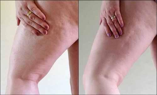 AromaDerm Cello Gel Medium 5.08 oz