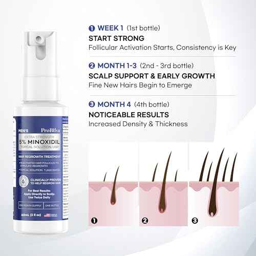 ProBliva 5% Minoxidil for Men Spray: Extra Strength 5% Minoxidil Topical Hair Growth Treatment - Clinically Proven Solution for Hair Loss & Thinning - Made in USA (2 Fl Oz (Pack of 1))
